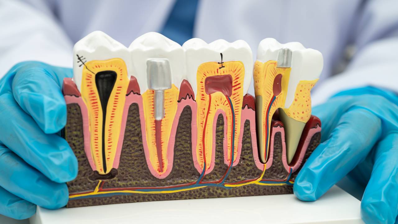 Unlocking Dental Bone Graft and Gum Disease Coverage Secrets