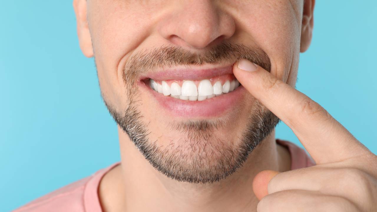 What counts as a chipped tooth emergency?
