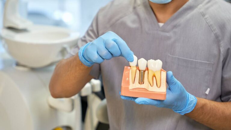 Can One Dentist Do Implants and Crowns?