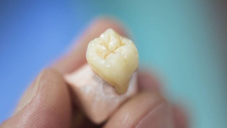 How Long Does a Dental Crown Take to Make?