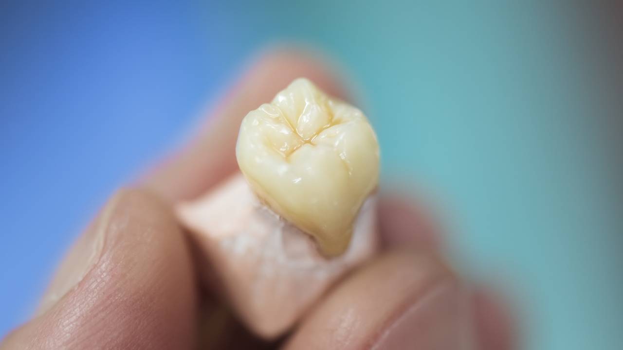 How Long Does a Dental Crown Take to Make?