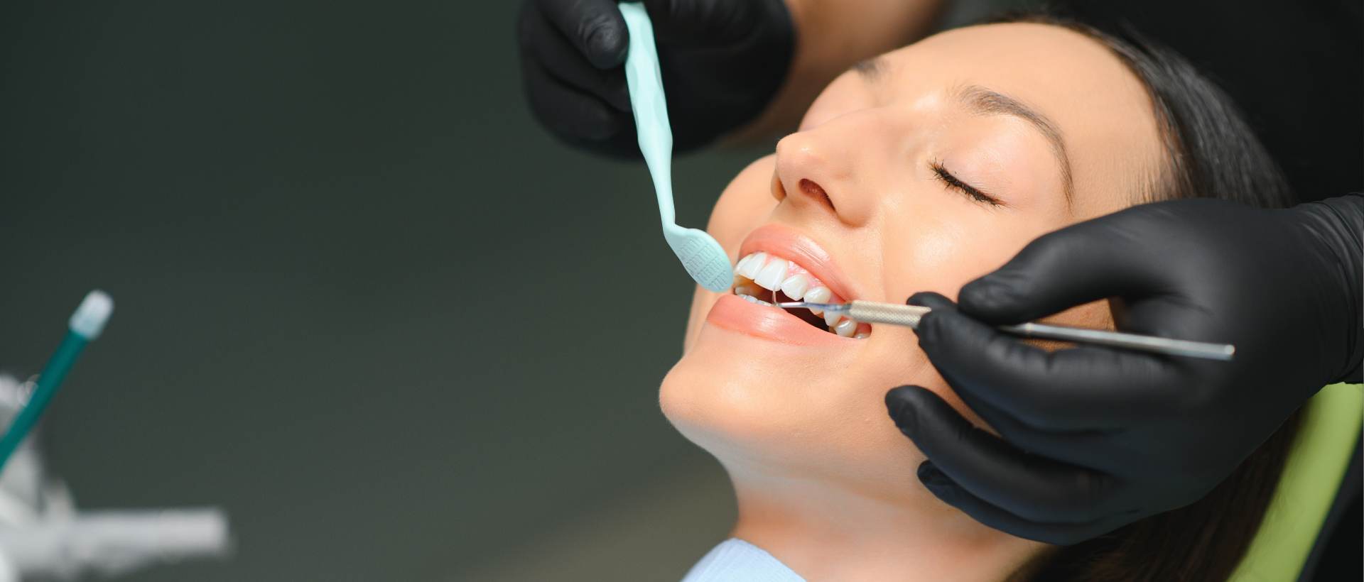 Fluoride Treatment