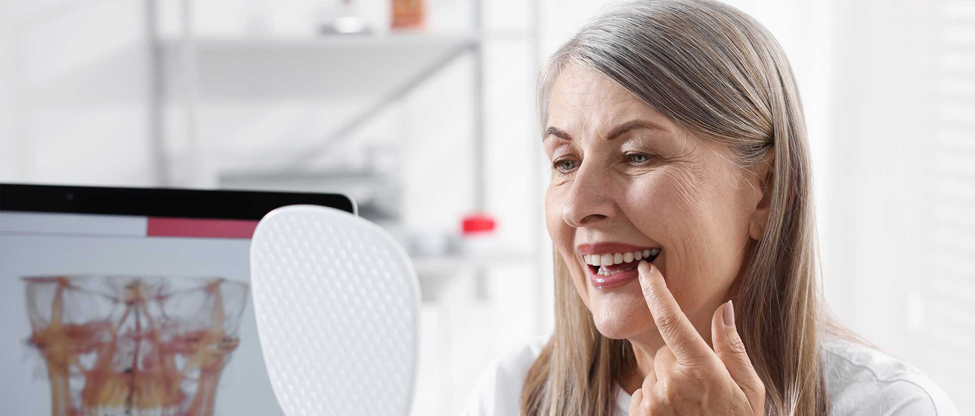 Implant-Supported Dentures